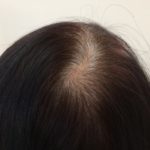 【Q&A】セルフで白髪染めをムラなく染めるコツは・・・?