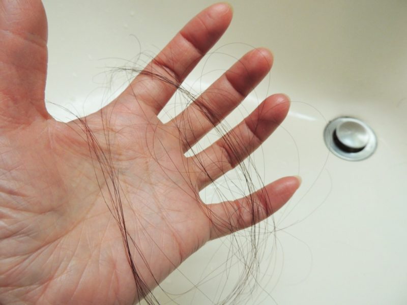 【QandA】ダメージのせいか髪の毛が異常に抜ける。いい抜け毛対策はありますか？