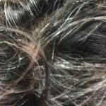 【QandA】体調を崩してからシャンプー類が合わなくなった。これって体質のせい？