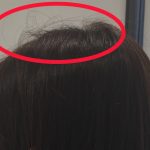 【QandA】アホ毛が気になります。切ったらなくなりますか？【@原宿】