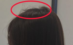 【QandA】アホ毛が気になります。切ったらなくなりますか？【@原宿】