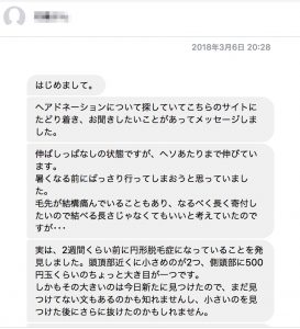【QandA】円形がある場合のヘアドネーションについて【@原宿】